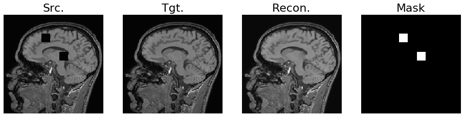 Series of images of the brain at different stages of the in-painting process