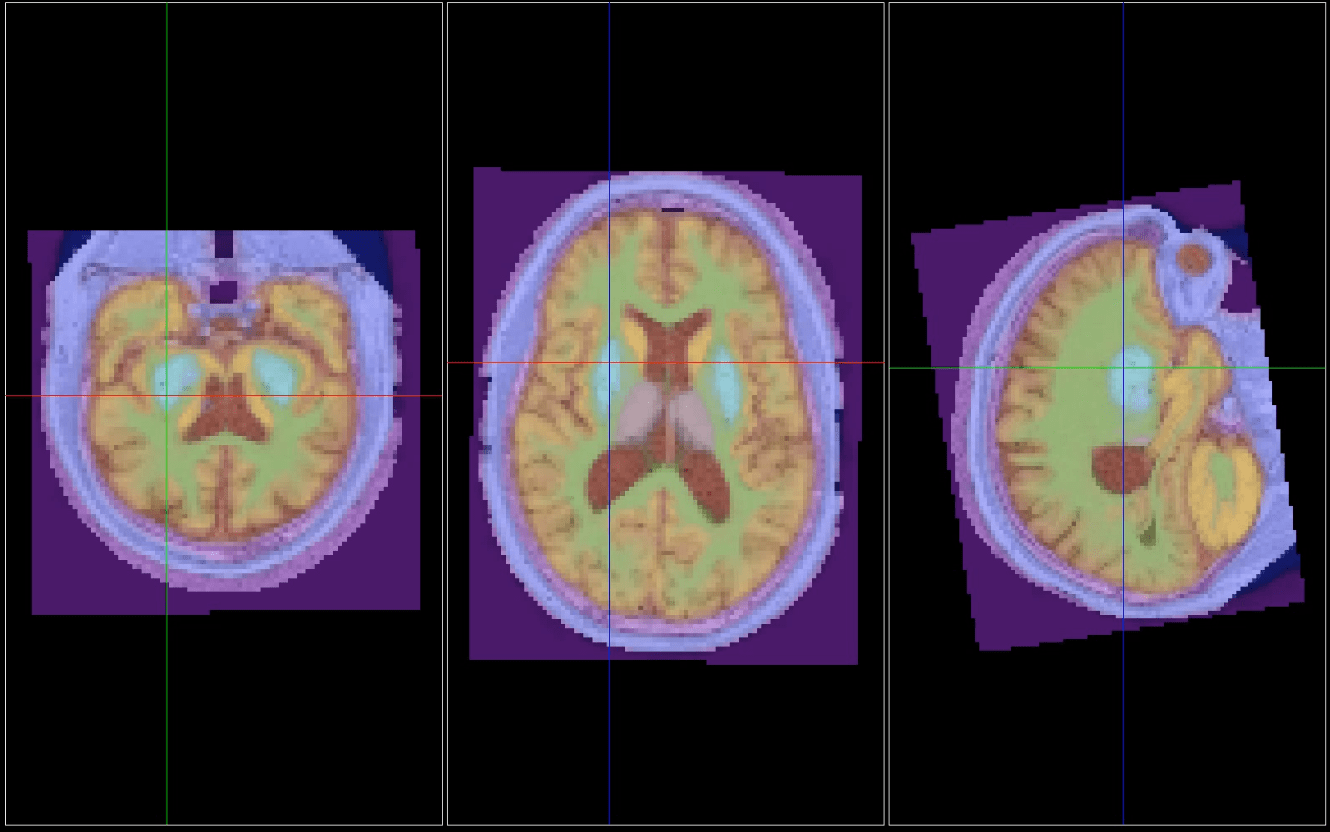 Corticometrics Brain View
